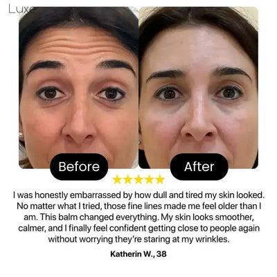 Luxe - Korean Eye Bag Eraser Balm Luxe Research