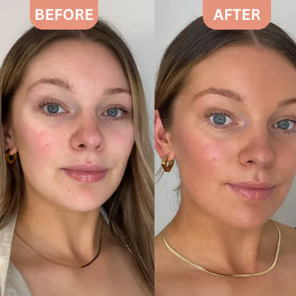 Luxe™ Tanning Drops -  Skin Glow Treatment